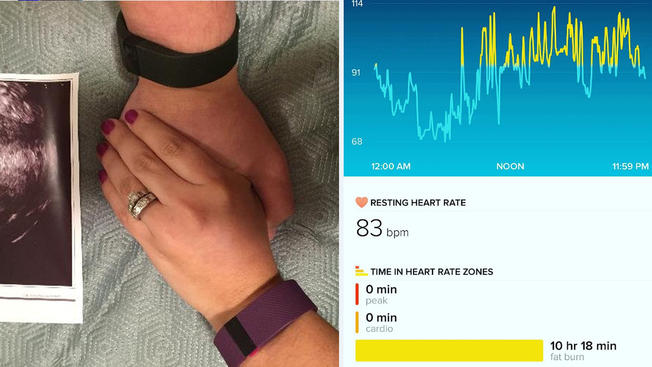 Couple Learns About Pregnancy Through Wife’s Fitbit (Video)
