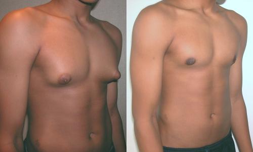 what are the side effects of taking dianabol